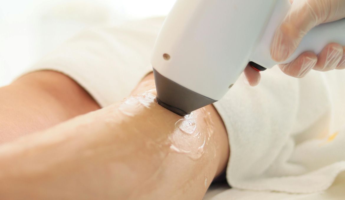 Laser Hair Removal Bundle Deals in Etobicoke