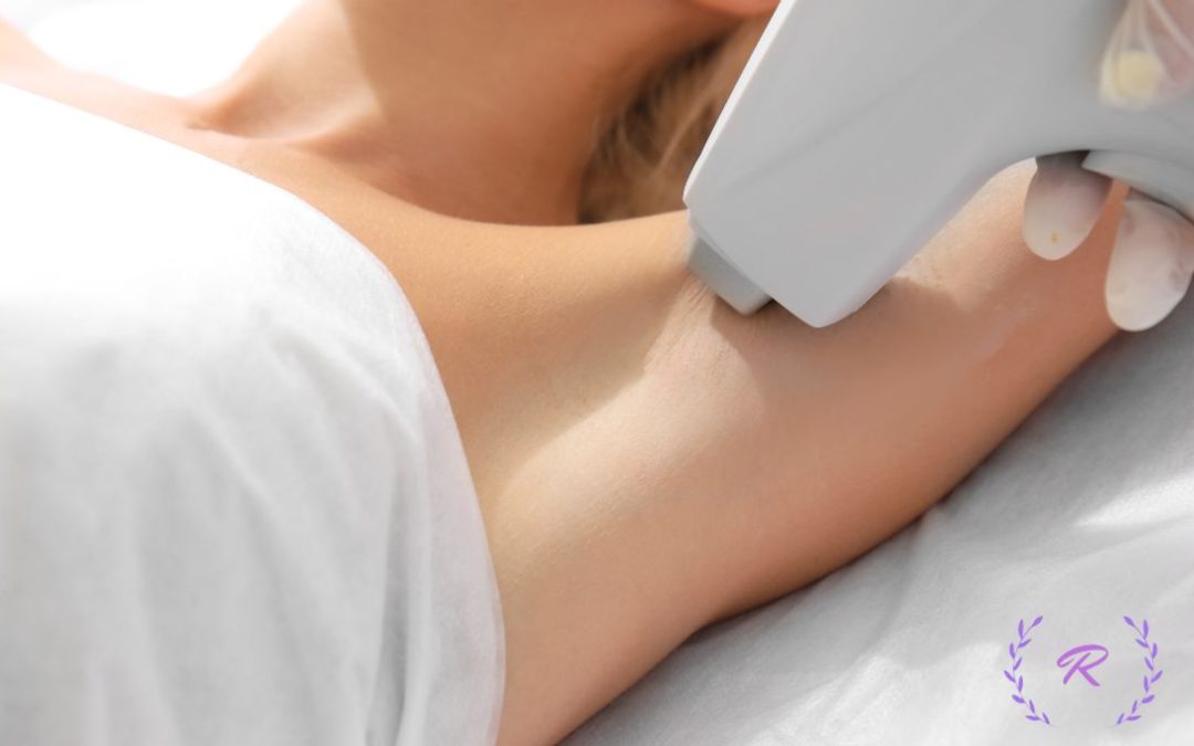 Laser Hair Removal for Sensitive Skin: What to Know Before Your First Session