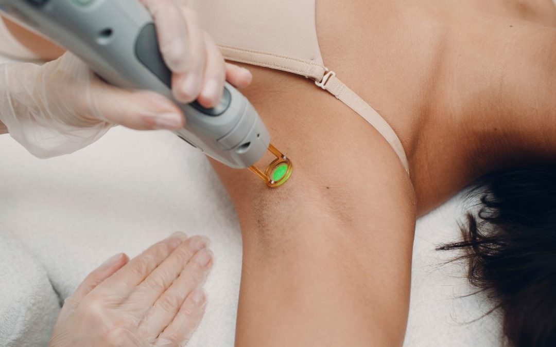 How Much Does Laser Hair Removal Cost in Etobicoke? A Real Pricing Guide