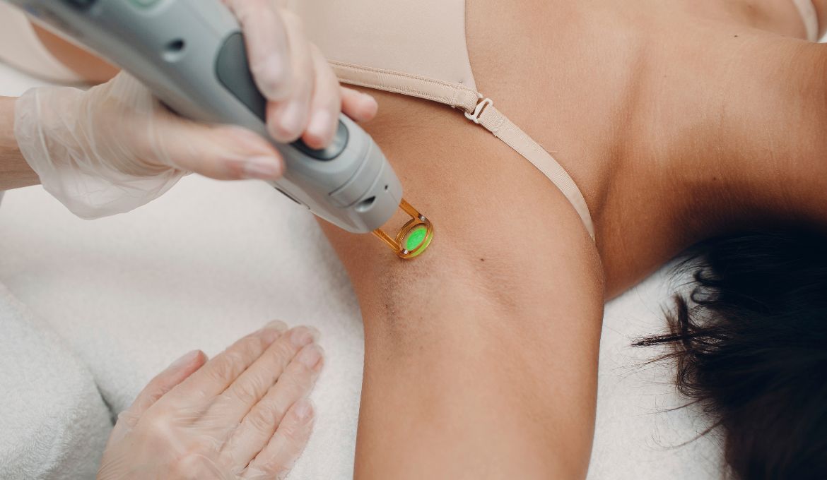 laser removal etobicoke Revitalize