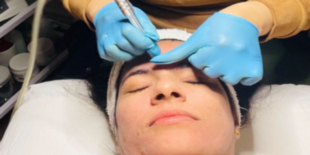 microdermabrasion revitalize spa etobicoke microdermabrasion revitalize spa etobicoke